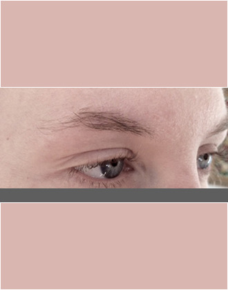before microblading procedure